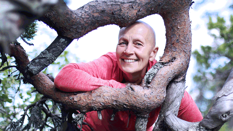 Anne Grimstad FJeld uten hår etter kreftbehandling 