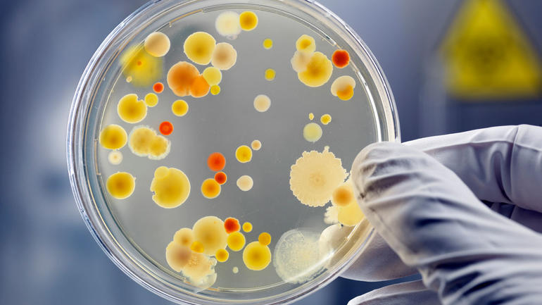 Bakteriekultur i glass. Foto: iStock/AndreasReh