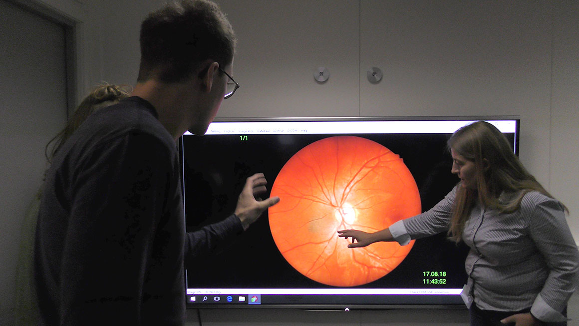To optikere som studerer øyet på skjerm